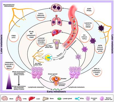 Specific classification and new therapeutic targets for neuroendocrine prostate cancer: A patient-based, diagnostic study